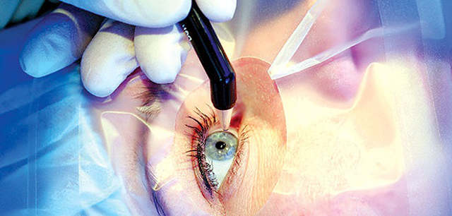 Операция по исправлению зрения
